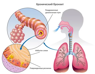 Дирофиляриоз — Текущее руководство для собак