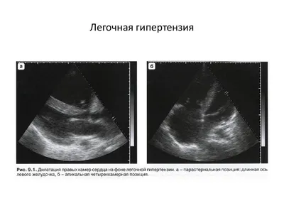 Усилен бронхососудистый картинки (49 фото) » Юмор, позитив и много смешных  картинок