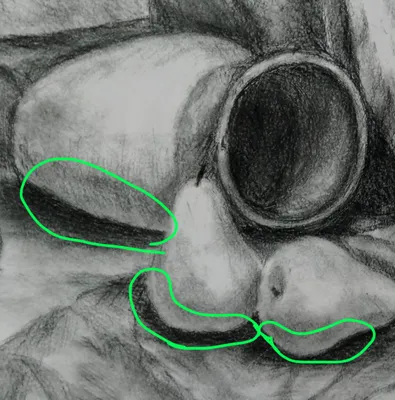 Зрачковый рефлекс / Pupillary light reflex