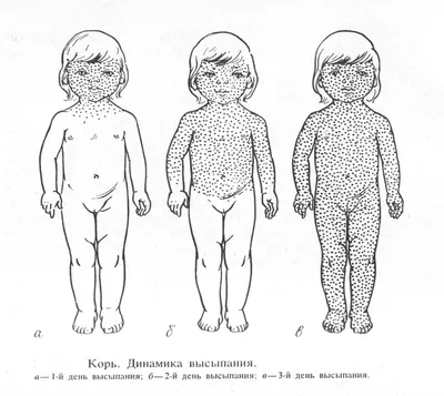 Шизофрения рисунки - 75 фото