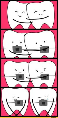 Зубы мудрости, брекеты и стоматологи - 10 смешных комиксов о зубах от  разных авторов | Смешные картинки | Дзен