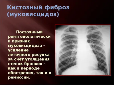 Самые распространенные результаты флюорографии и их значение » Скальпель -  медицинский информационно-образовательный портал