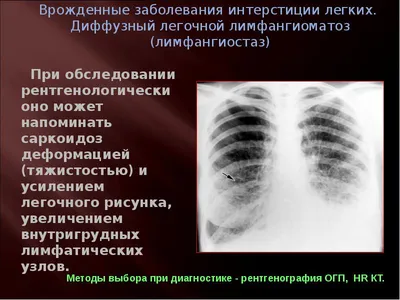 Рентгенология | PDF