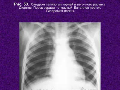 Презентация на тему: \"Лектор – доцент кафедры семейной медицины ФПО ДГМА  к.м.н - Василевская Ирина Васильевна 2014 Рентгенография органов грудной  клетки.\". Скачать бесплатно и без регистрации.