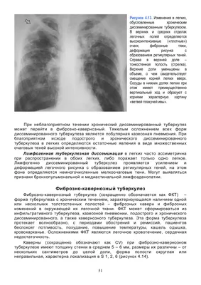 На R-грамме органов грудной полости определяется диффузное усиление,  обогащение. Деформация легочного рисунка; корни.. | ВКонтакте