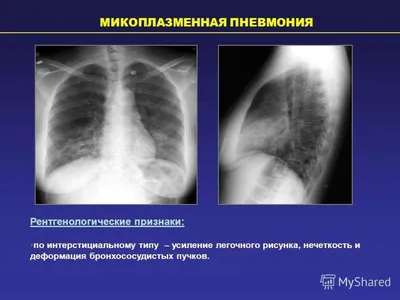 Детство, детство... | Портал радиологов