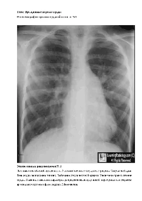 Лучевое исследование органов дыхания - презентация онлайн