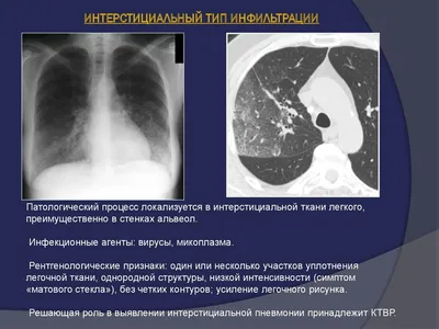 Рентгенограммы реальных пациентов. Бабушка 80лет находящаяся на лечении в  хирургическом отделении по поводу.. | ВКонтакте