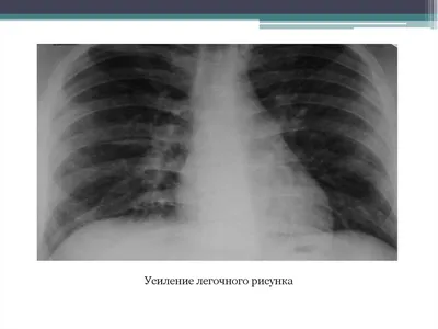 Рентгенография в диагностике заболеваний органов грудной  клетки:Учеб.пос.В.В.Мельников. 2017 - флипбук страница 151-190 | FlipHTML5