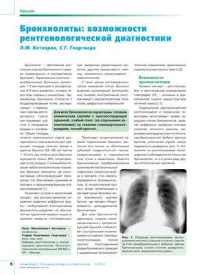 Передняя обзорная рентгенограмма органов грудной полости презентация,  доклад, проект