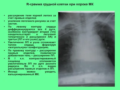 Рентгенография в диагностике заболеваний органов грудной  клетки:Учеб.пос.В.В.Мельников. 2017 - флипбук страница 51-100 | FlipHTML5