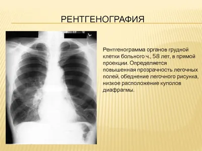 Консультация рентгенолога и радиолога, описание и заключение рентгенограмм