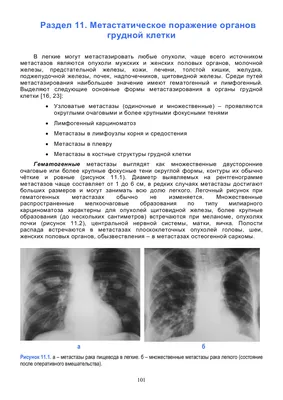 Бронхиолиты: возможности рентгенологической диагностики – тема научной  статьи по клинической медицине читайте бесплатно текст  научно-исследовательской работы в электронной библиотеке КиберЛенинка